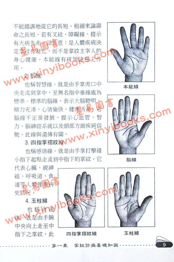 赵理明：掌纹诊病实例分析图谱